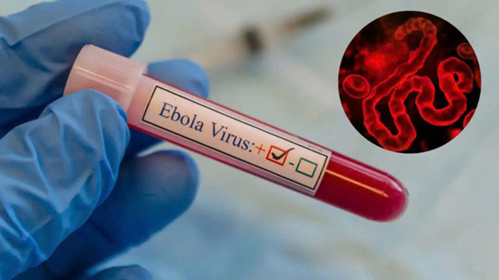 RDC : L’épidémie d’Ebola atteint 2 181 cas confirmés et 864 décès